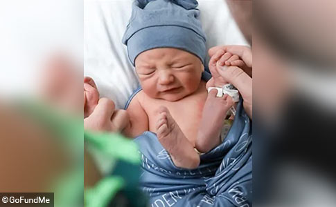 Newborn bit by a dog head injury